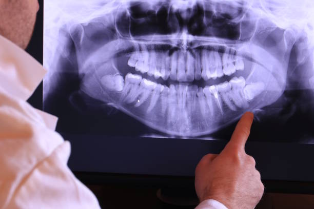 Best Emergency Treatment for Toothache in Sardis, MS